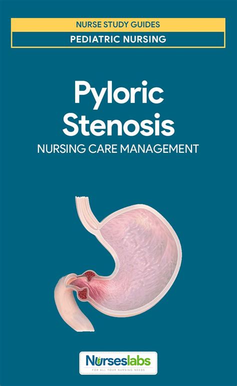 Pyloric Stenosis Nursing Care Management And Study Guide Nursing Care