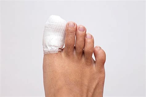 The Differences Between A Sprained Toe And A Broken Toe