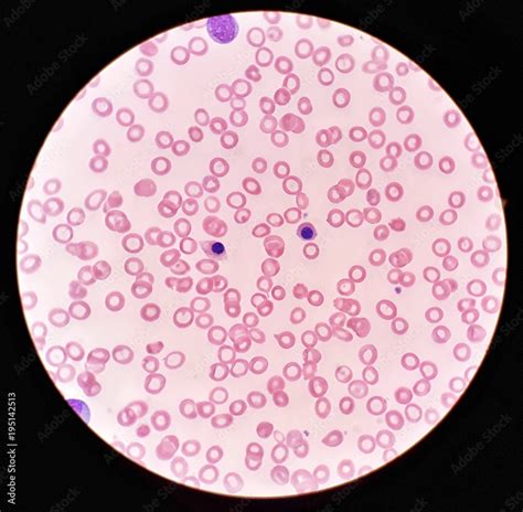 Human Blood Smear Under 100x Light Microscope With Nucleated Red Blood