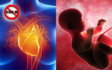 Bernama Can Women With Heart Disease Have A Safe Pregnancy