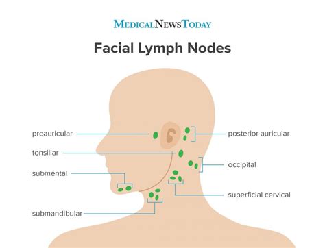 Pin By Christine Haden On Glands Lymphsinuses In 2020 Lymph Nodes