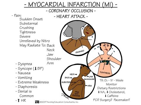 Myocardial Infarction Nursing Diagnosis Home School