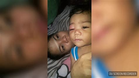 Kinagat Ng Ipis Ang Baby Ko Comment Down Kung Ano Ang Gamot Sa Kagat