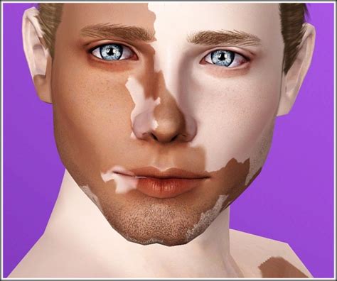 The Sims 4 Vitiligo Simplypixelated Vitiligo Overlay Child