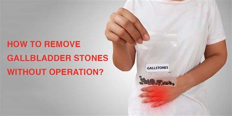 How To Remove Gallbladder Stones Without Operation Pristyn Care