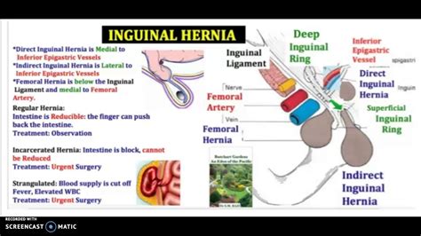 What Is A Hernia How To Tell If You Have A Hernia