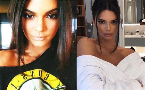 Kendall Jenners Unrecognisable Before And After Pictures That Suggest