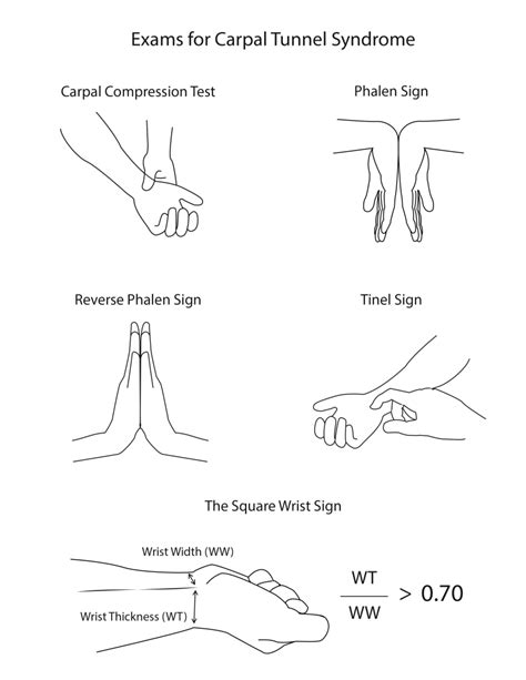 Figure Carpal Tunnel Physical Exam Maneuvers That Test For Carpal