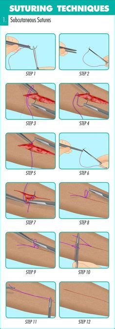 Complete Guide To Mastering Suturing Techniques Medical Education