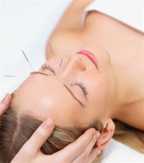 Cosmetic Acupuncture Sana Acupuncture And Wellness Center Elizabeth Nj