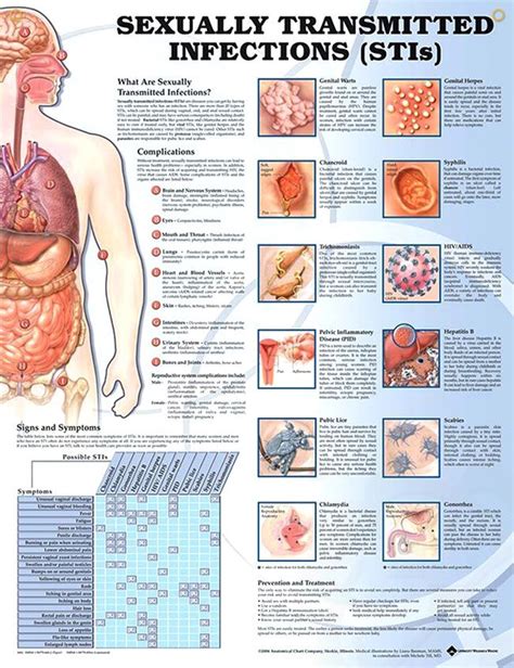 Sexually Transmitted Infections Anatomy Poster Explains And Illustrates