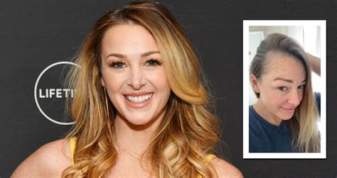 Jamie Otis Opens Up About Her Postpartum Hair Loss Myhealthyclick Com