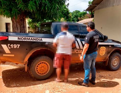 Maternidade Realiza Interrupção De Gravidez Em Criança De 11 Anos Estuprada Pelo Avô Em Rr