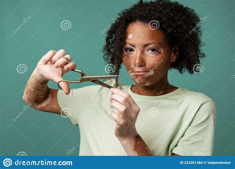 Young Woman With Vitiligo Cutting Her Hair And Looking At Camera Stock