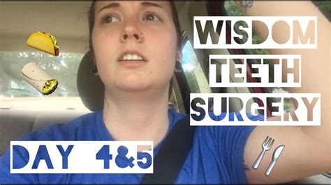 Some patients are able to return to work. Wisdom Teeth Vlog Day 4&5 - Food and Dentist - YouTube