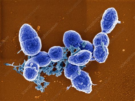 Streptococcus Pneumoniae Sem Stock Image B2360150 Science Photo