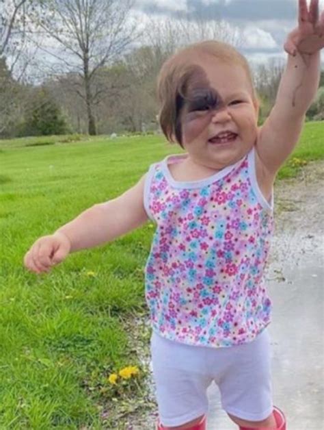 This Wonderful Youngster With A Rare Disease Has A Distinct Beauty And