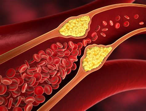 Why Keeping Healthy Cholesterol Levels Is Crucial - Everlywell: Home ...