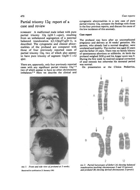 PDF Partial Trisomy 2q Report Of A Case And Review