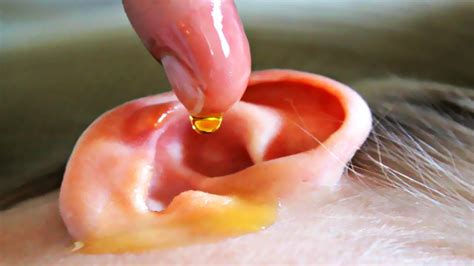 Earwax is a waxy material produced by glands inside the ear. Mega Ear Wax Removal Compilation; What is Ear Wax? - YouTube