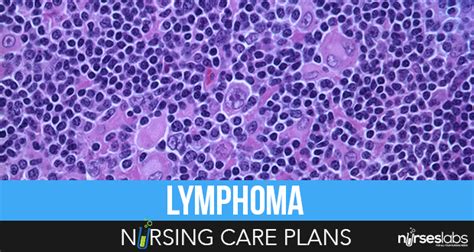 3 Lymphoma Nursing Care Plans Nurseslabs Nursing Care Plan Care