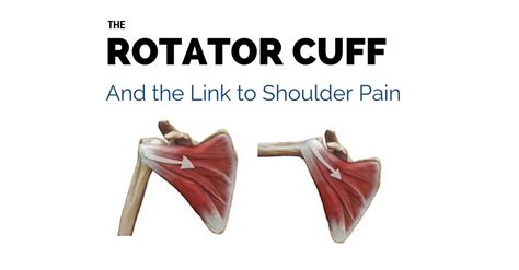 Rotator Cuff Problems And Shoulder Pain Gray Chiropractic St