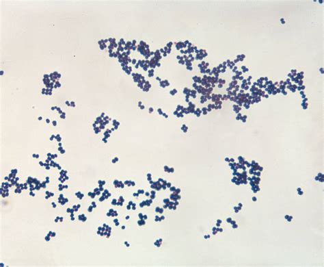 Staphylococcus Aureus E Lantibiotico Resistenza Microbiologia Italia