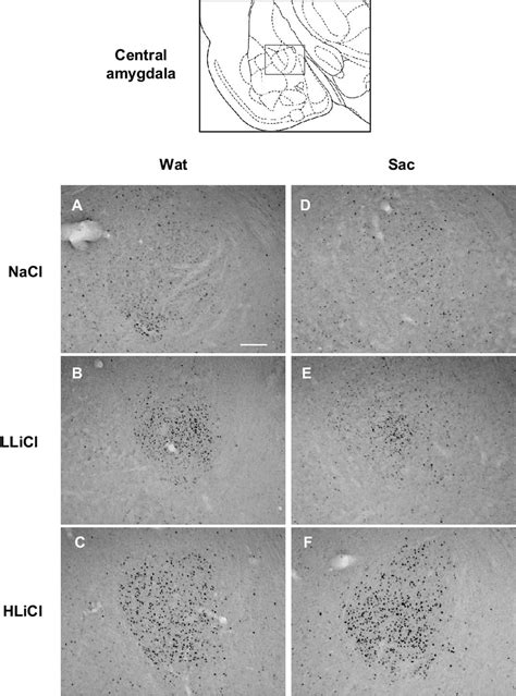 Photomicrographs Depicting Fos Labeling Within The Central Nucleus Of Download Scientific