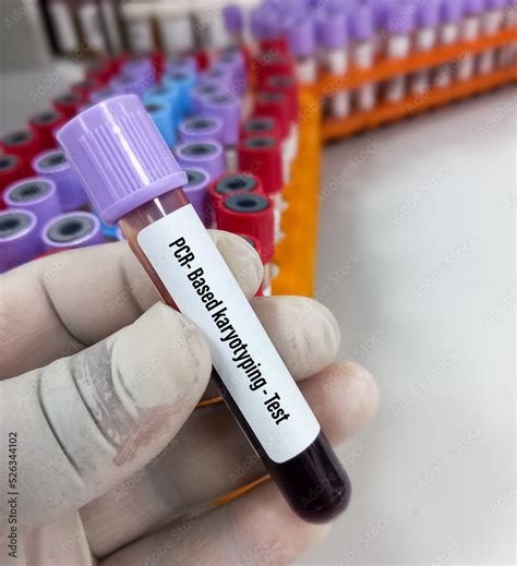 Blood Sample For Pcr Based Karyotyping Testing Genetic Disorder