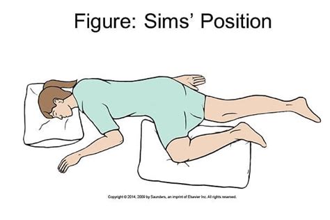 Nurse Step Sims Position Named After The Gynaecologist Facebook