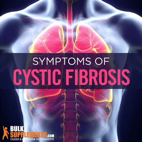 cystic fibrosis disease