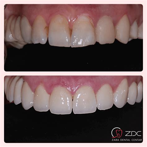 Zara Dental Centar Zadar Dentist Dental Clinic Zadar Implantology