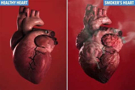 Grim Video Reveals The Devastating Toll Smoking Takes On Your Heart The Irish Sun