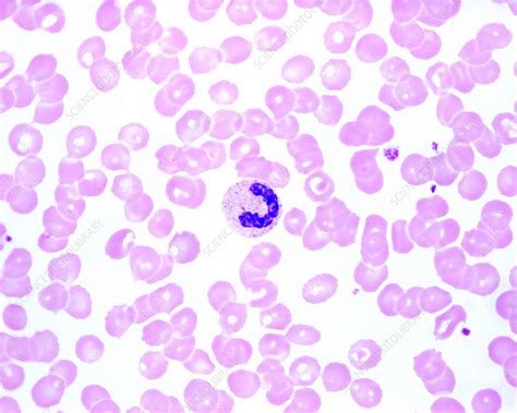 Human Blood Smear Light Micrograph Stock Image C0558186 Science