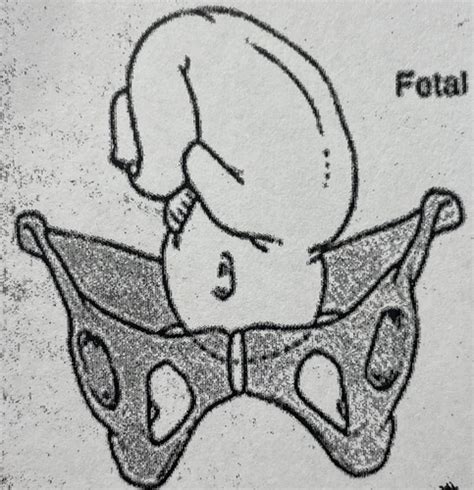 Fetal Positions Nu342 Flashcards Quizlet