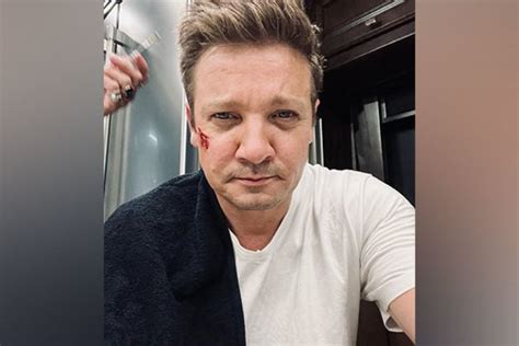 Jeremy Renner Receiving Electro Therapy Treatment To Recover From