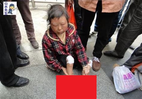 B 【閲覧注意】中国で話題。路上で助けを求める足がミイラ化した48歳の女性 ポッカキット