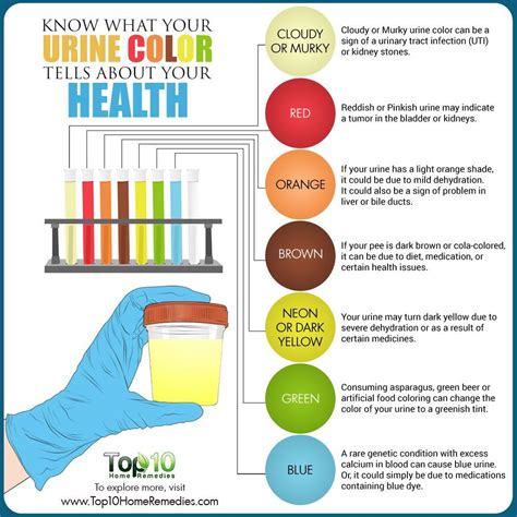 Pashab Ka Raga Urine Color Changed Know Why Dreducation Hindi Mrs Pip Urine Colors Chart