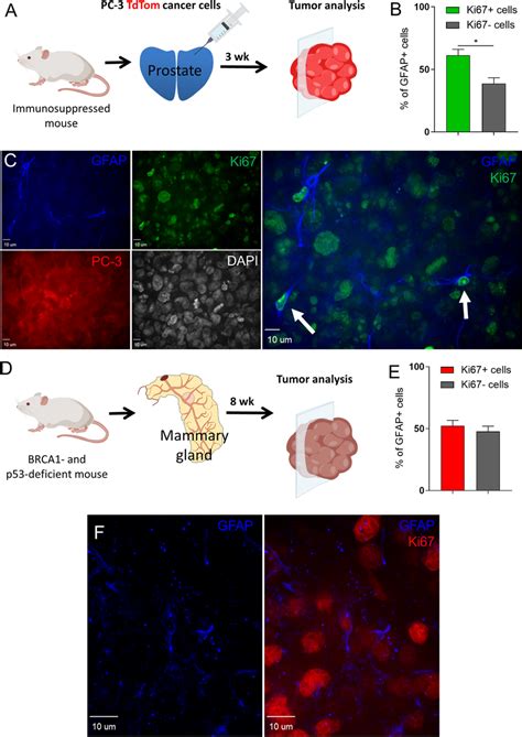 Tumoral Gfap Cells Proliferate Within The Tumor Microenvironment A