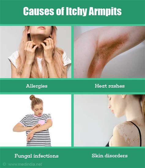 Itchy Armpits Causes Prevention And Treatment