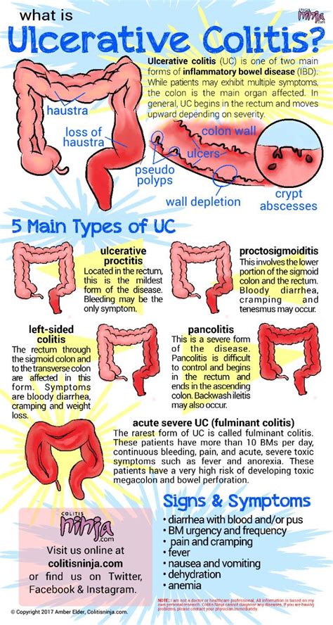 Ulcerative Colitis Ulcerative Colitis Gastrointestinal Nursing