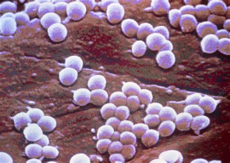 Staphylococcus Bacteria Stock Image B2340039 Science Photo Library