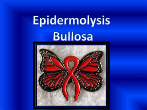Ppt Epidermolysis Bullosa Powerpoint Presentation Id4495150