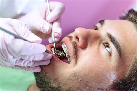 Melrose Orthodontics Orthodontist Melrose Ma Pan Dental Care