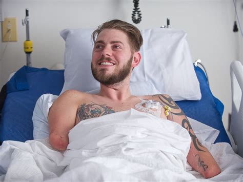 Veteran Plans To Get Dream Job As Chef After Double Arm Transplant