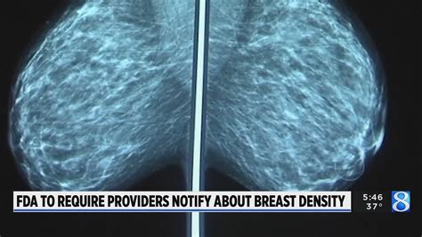 Us Requires New Info On Breast Density With All Mammograms Youtube