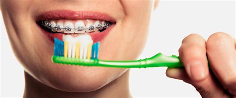 Proper Care For Your Teeth When You Have Braces Gso