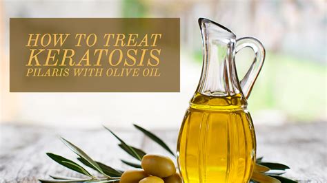 Keratosis pilaris signs and symptoms. How to Treat Keratosis Pilaris with Olive Oil?