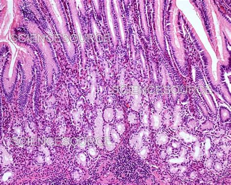 Photograph Gastric Mucosa Pyloric Region LM Science Source Images