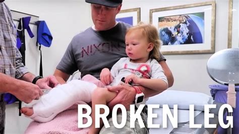 Getting A Cast On Her Broken Leg Youtube